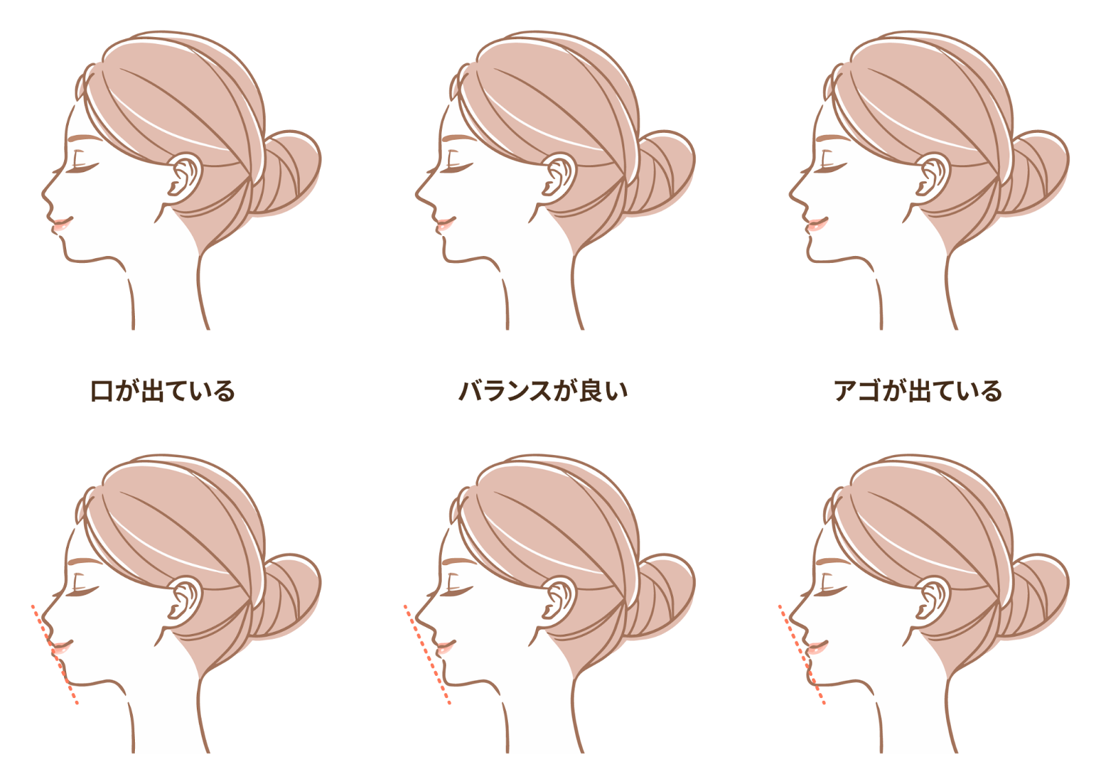 チェックでわかる横顔の印象