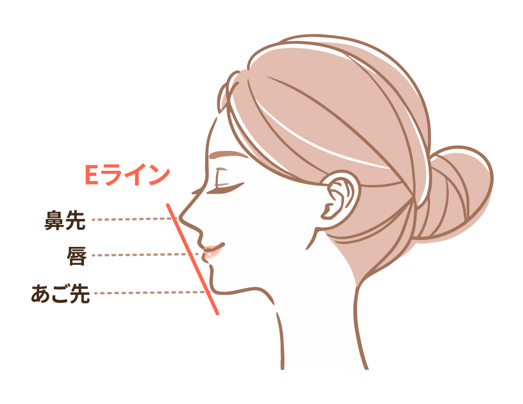 Eラインとは