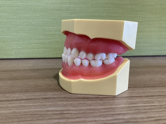 受け口の特徴