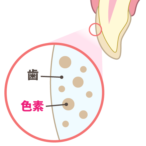 ホワイトニングのメカニズム